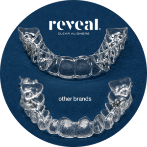 Reveal Clear Aligners versus other brands